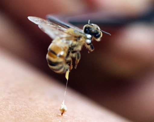 Bal arısı ısırığı neye yardımcı olur?